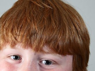 red-haired boy close-up - MortonPhotographic/iStock/Getty Images