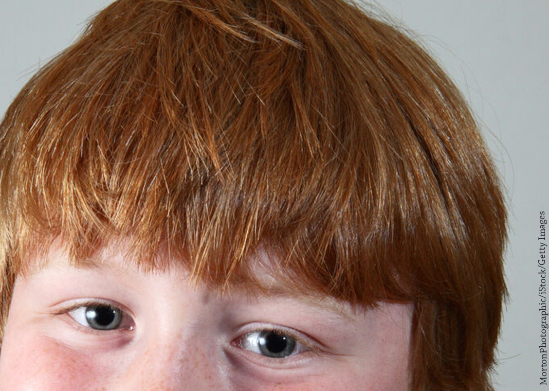 red-haired boy close-up - MortonPhotographic/iStock/Getty Images